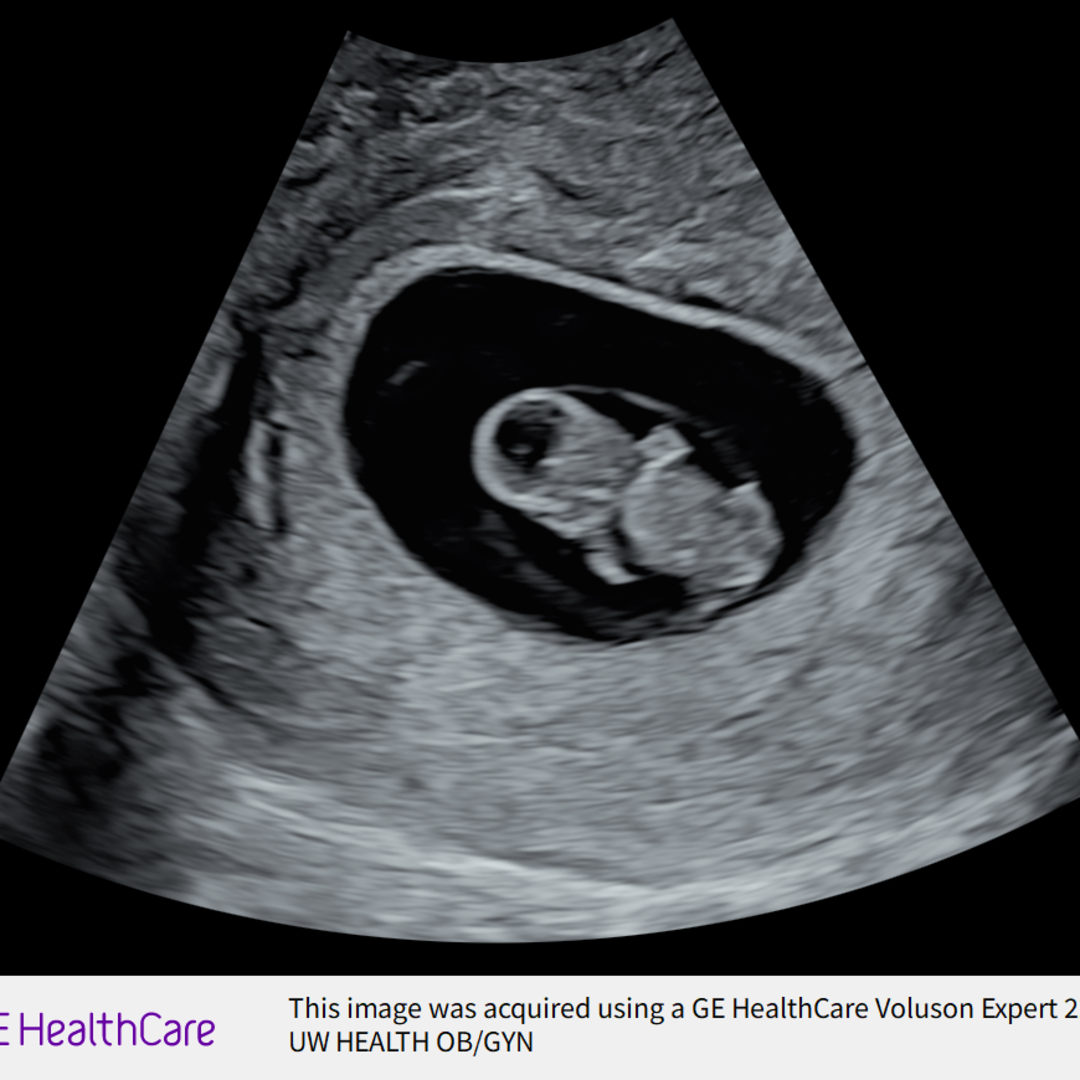 Photo shared by Marieglis for their Babylist baby registry.