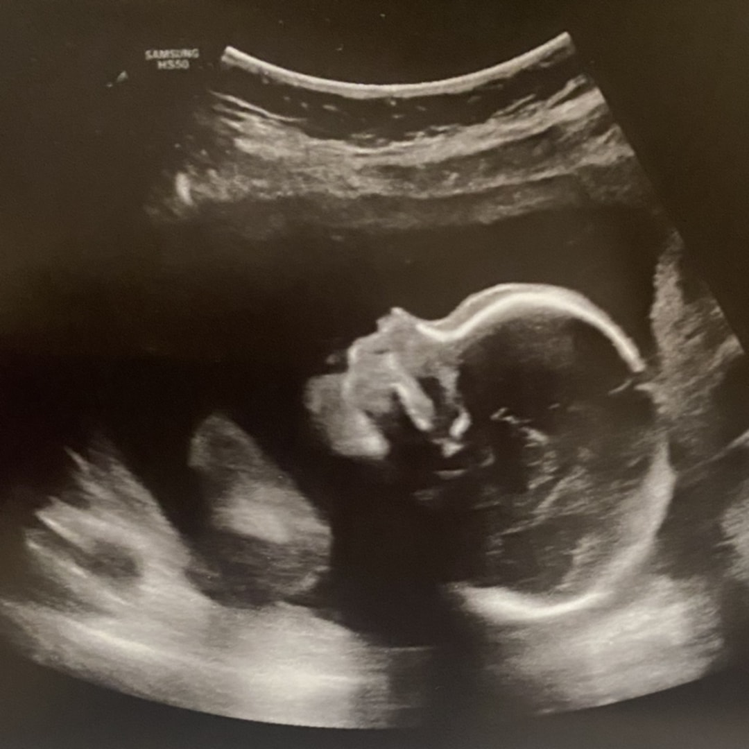 Photo shared by Emily for their Babylist baby registry.