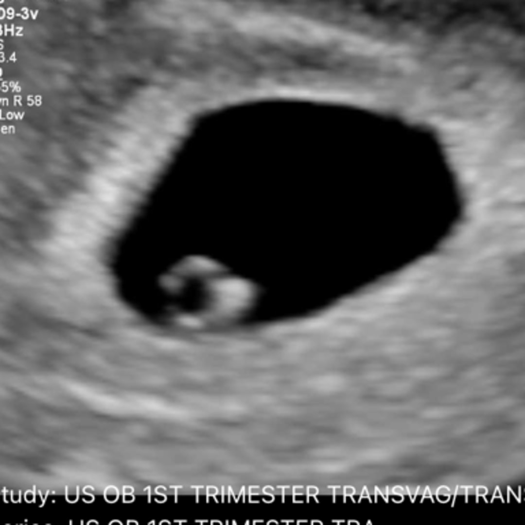 Photo shared by Justice for their Babylist baby registry.