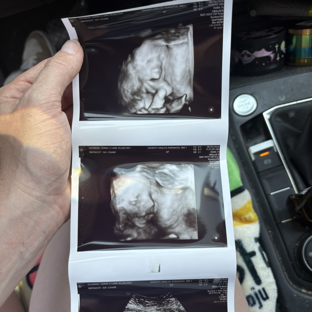 Photo shared by Emma for their Babylist baby registry.