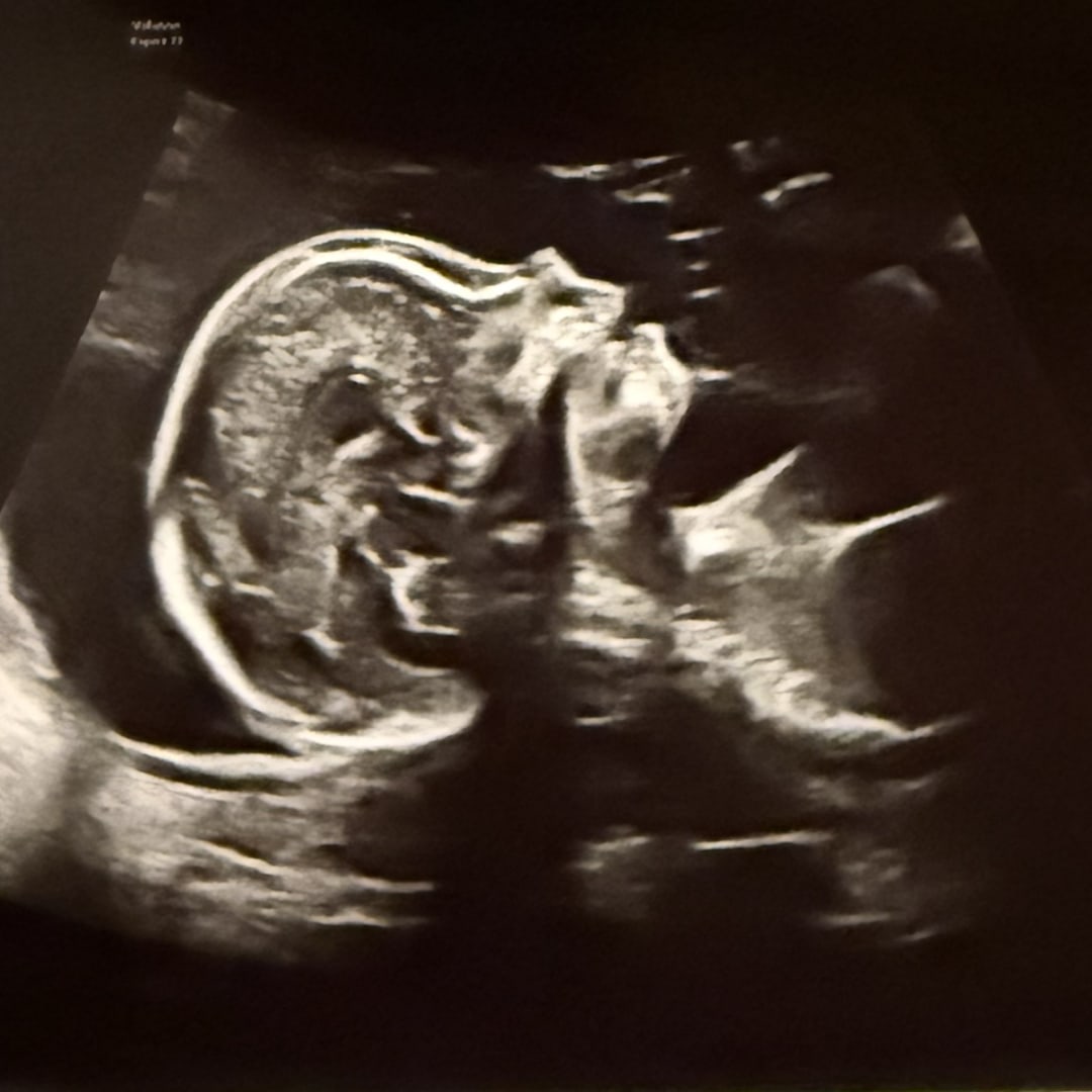 Photo shared by Nathalie for their Babylist baby registry.