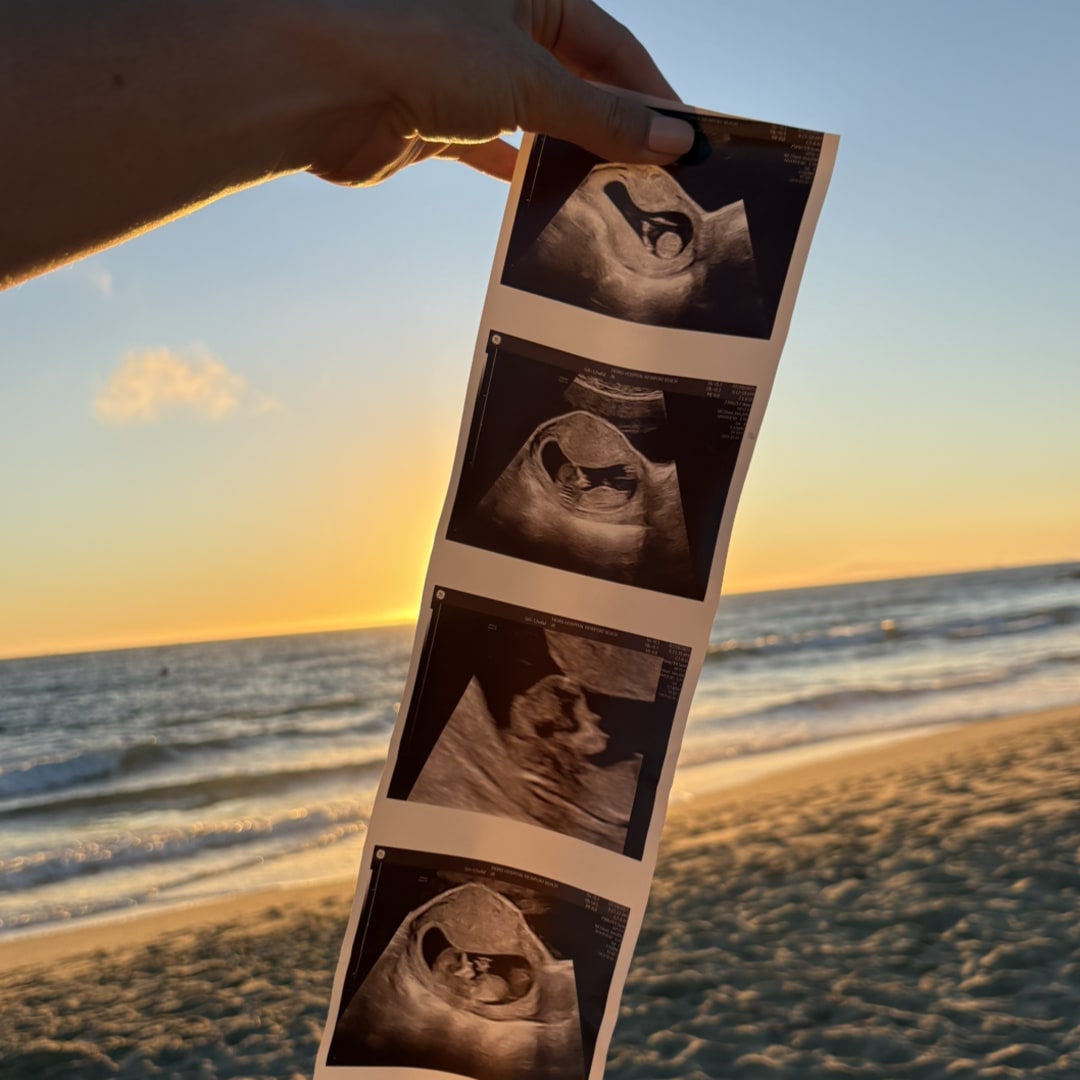 Photo shared by Kaila for their Babylist baby registry.