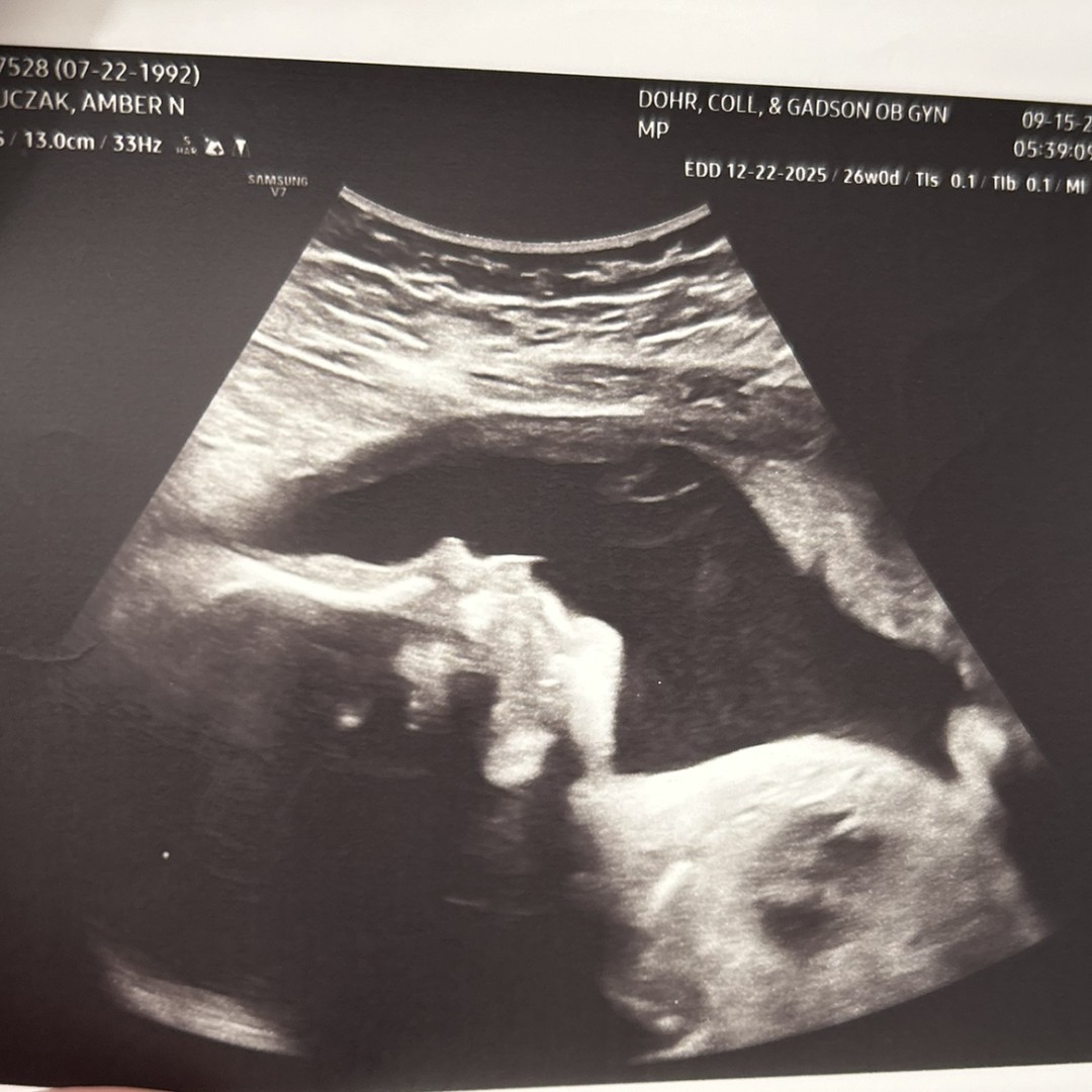 Photo shared by Amber for their Babylist baby registry.