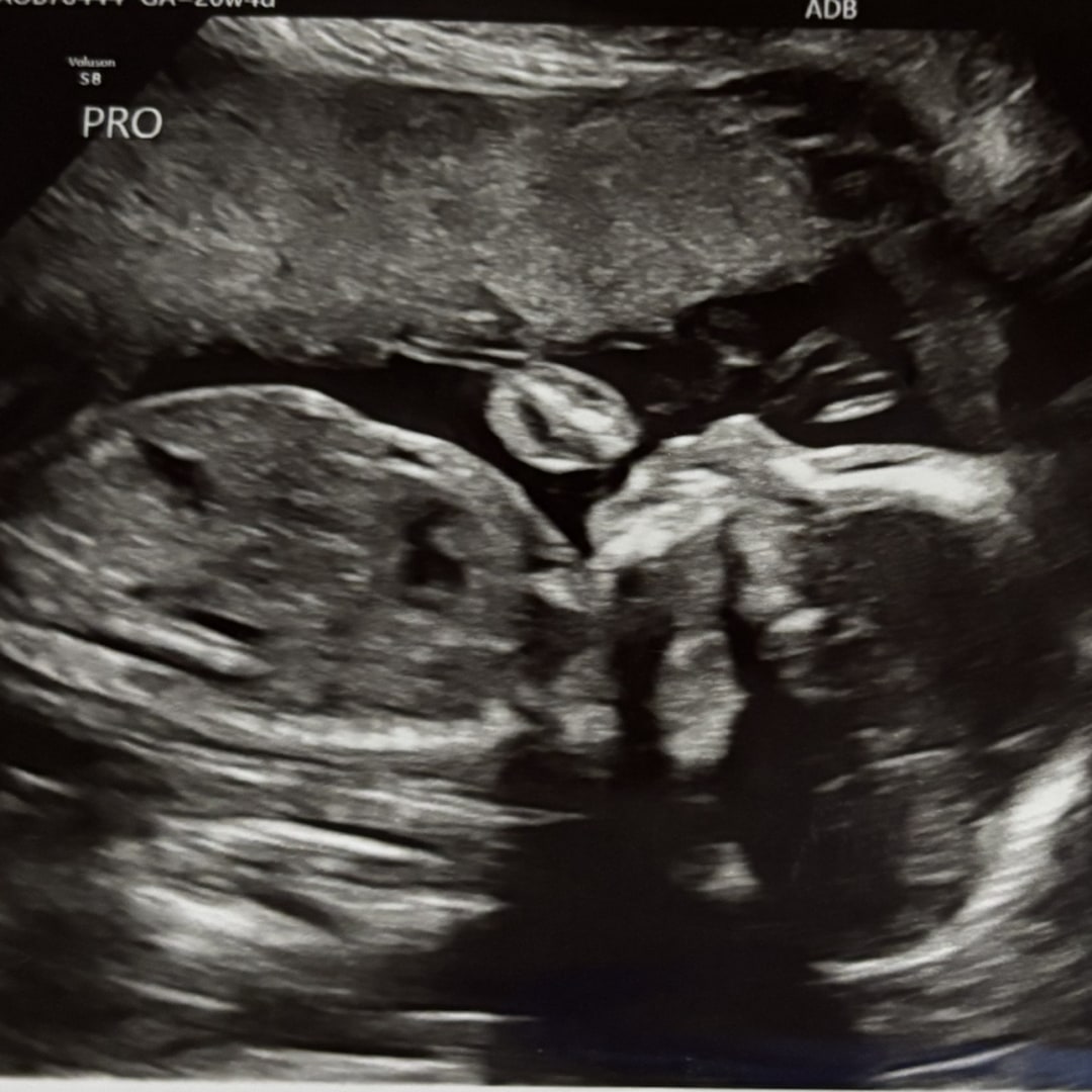 Photo shared by Fabiola for their Babylist baby registry.