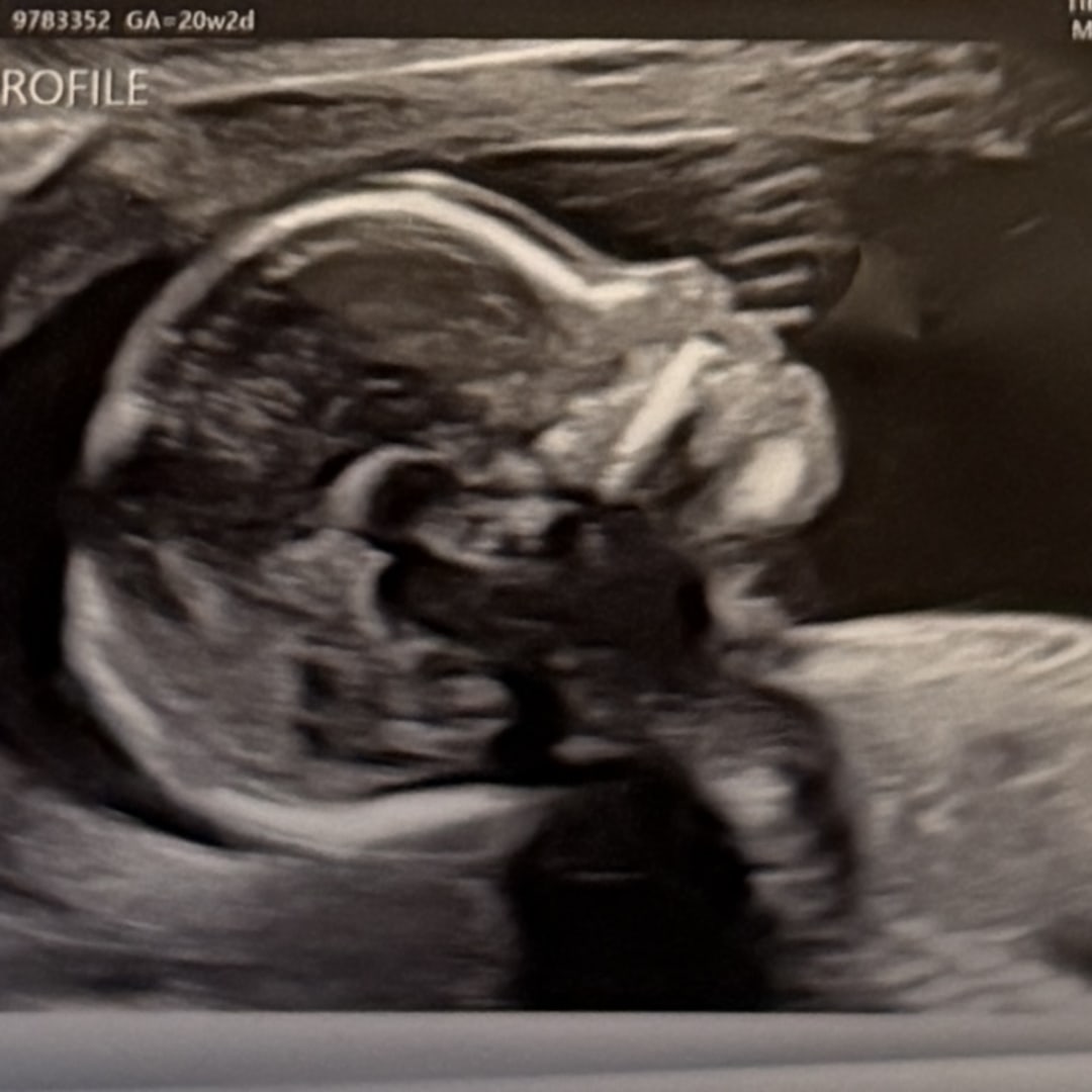 Photo shared by Lydia for their Babylist baby registry.