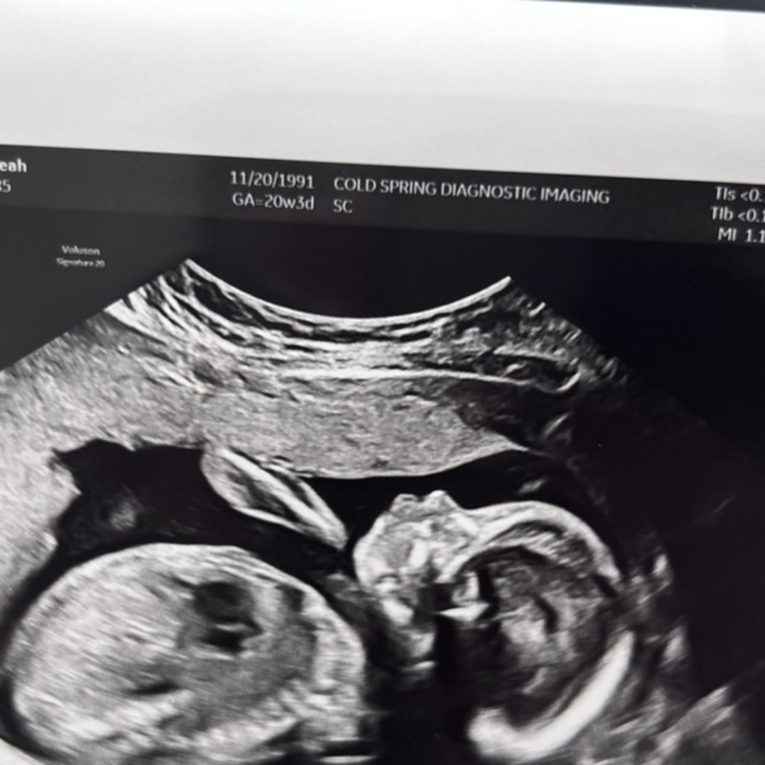 Photo shared by Aleah for their Babylist baby registry.