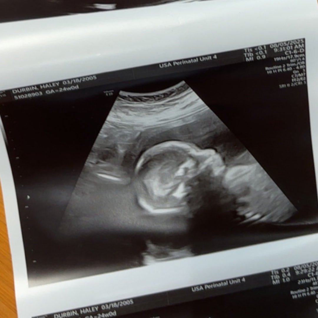 Photo shared by Haley for their Babylist baby registry.