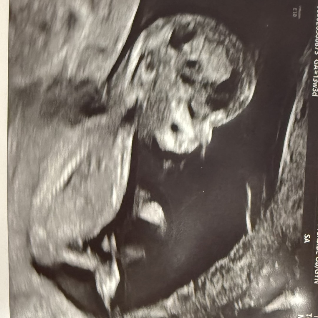 Photo shared by Trinity for their Babylist baby registry.