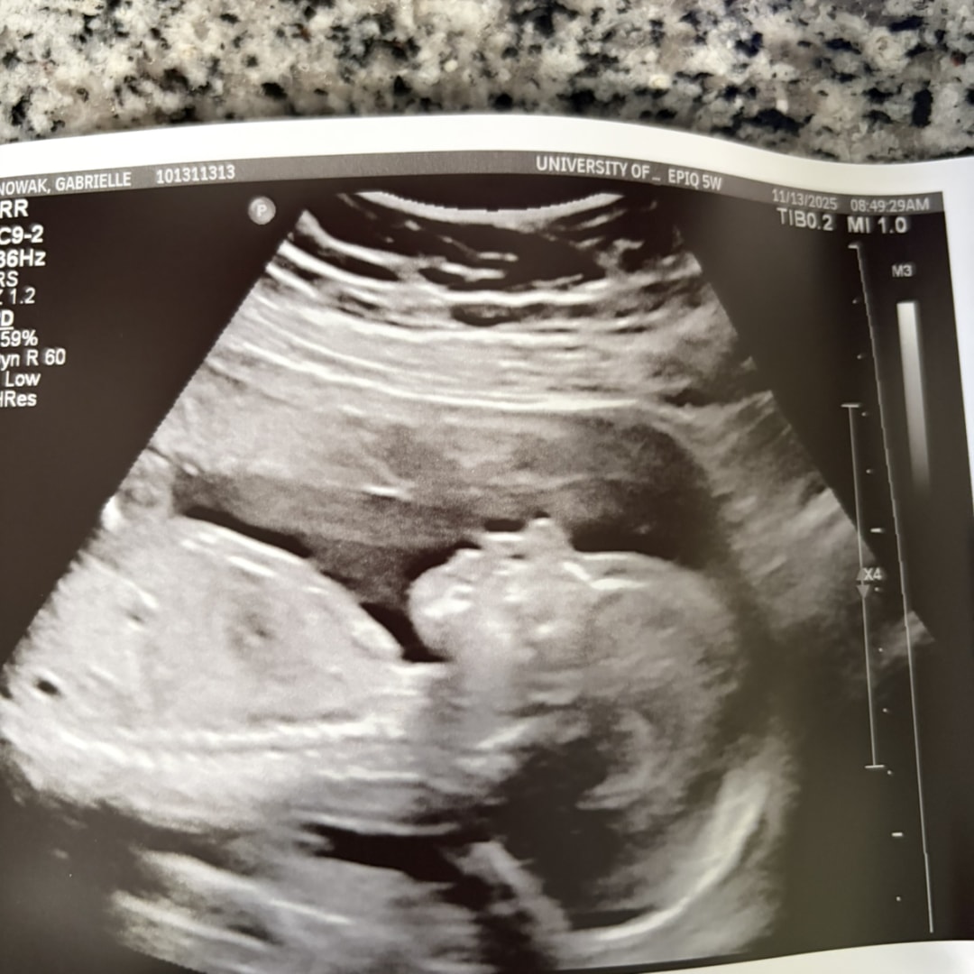 Photo shared by Gabrielle for their Babylist baby registry.