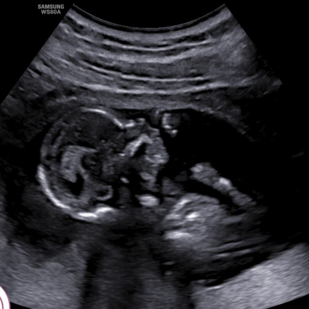 Photo shared by Lyric for their Babylist baby registry.