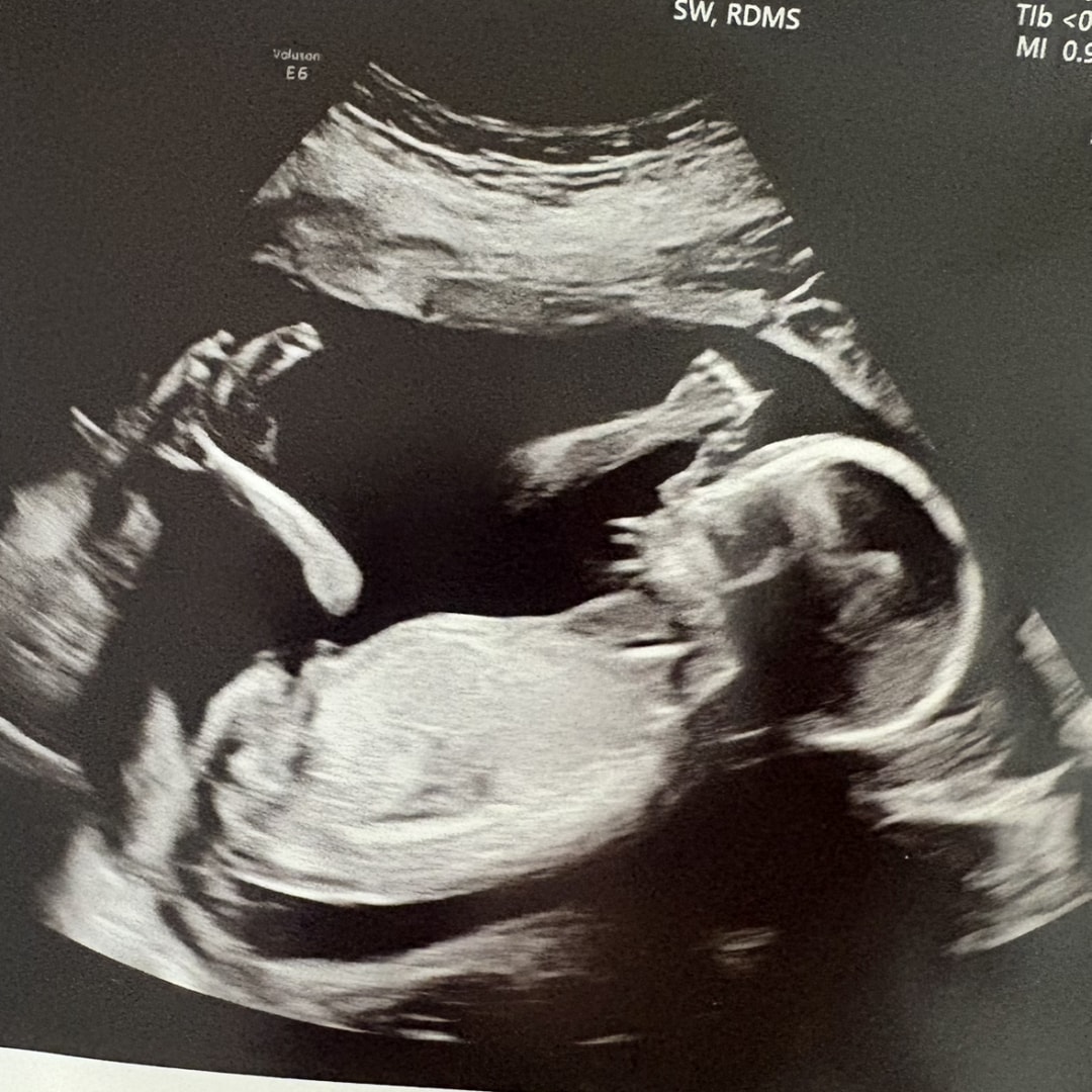 Photo shared by Madison for their Babylist baby registry.