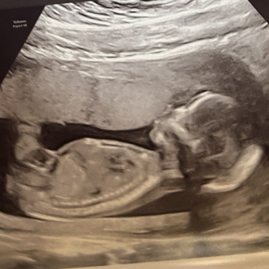 Photo shared by Alexandra for their Babylist baby registry.