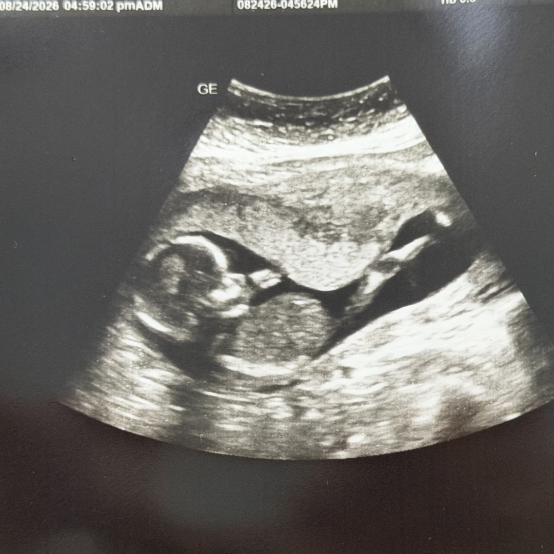 Photo shared by Angelica for their Babylist baby registry.