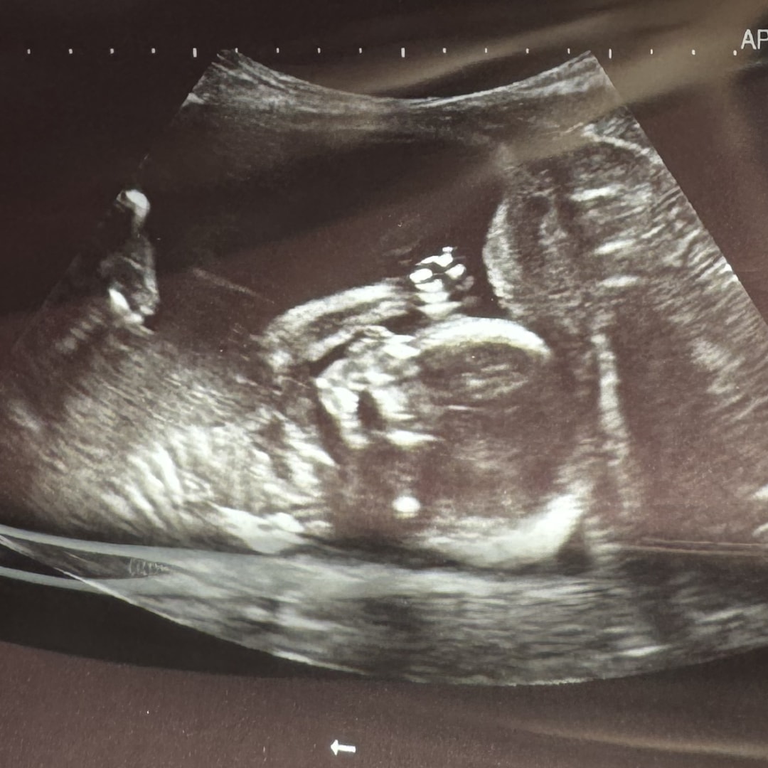 Photo shared by Courtney/Thomas for their Babylist baby registry.