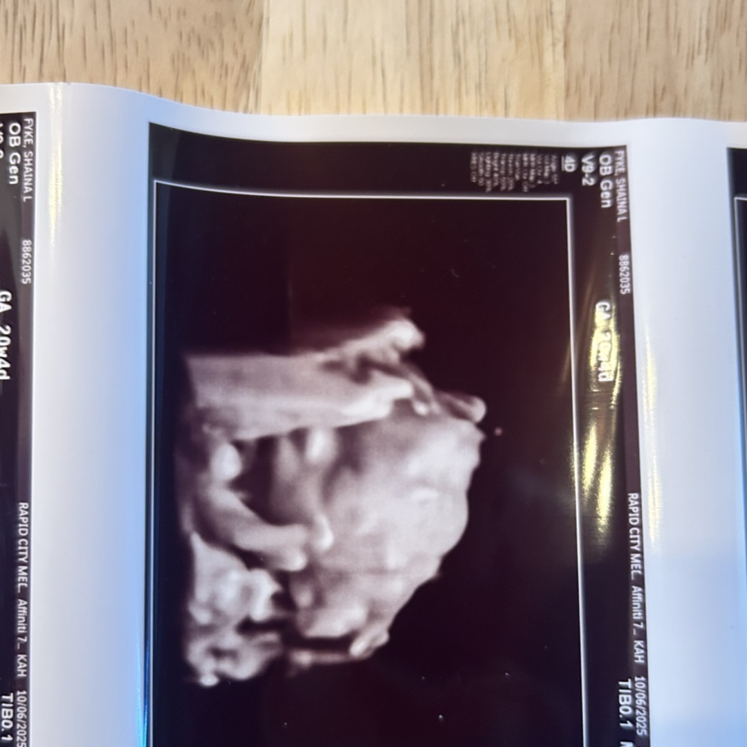 Photo shared by Shaina for their Babylist baby registry.