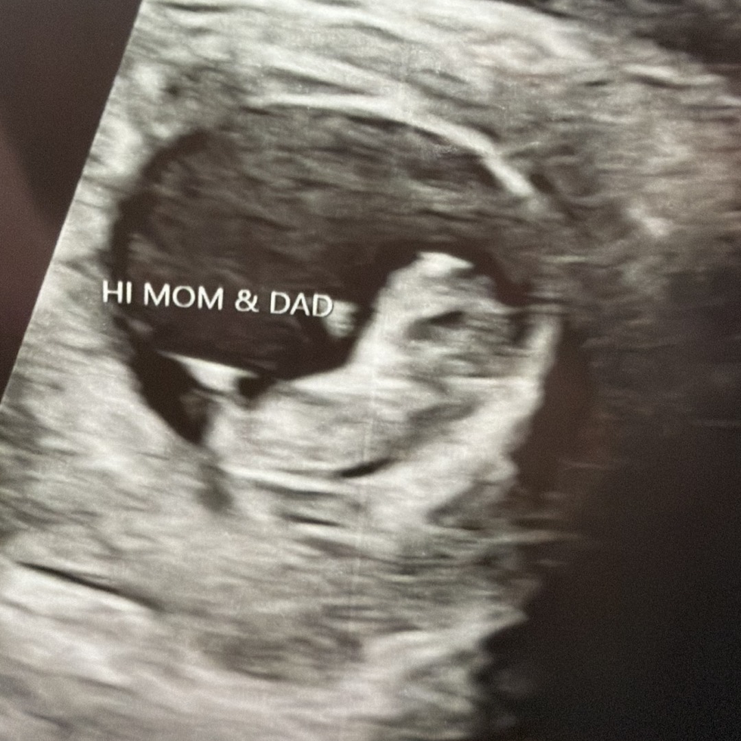 Photo shared by Carina for their Babylist baby registry.