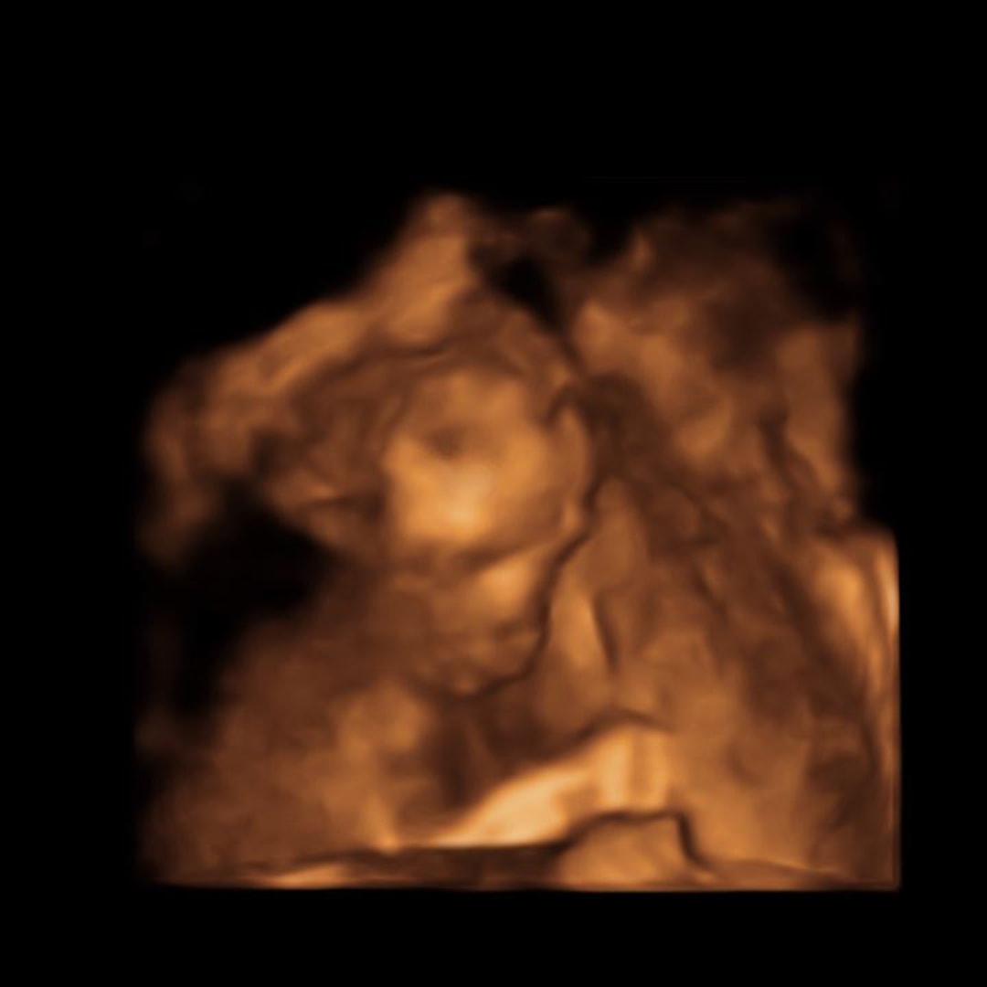 Photo shared by Destiny for their Babylist baby registry.