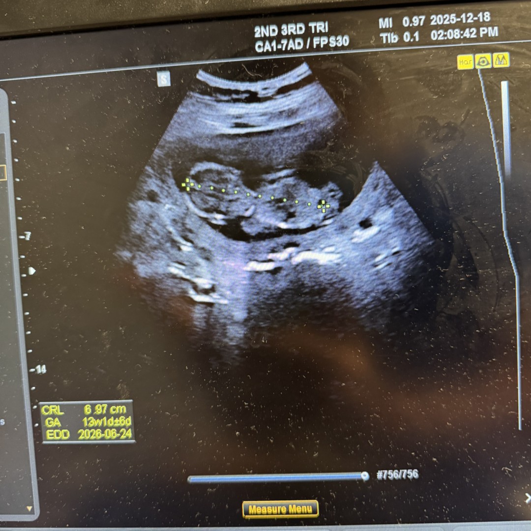 Photo shared by Cristian for their Babylist baby registry.