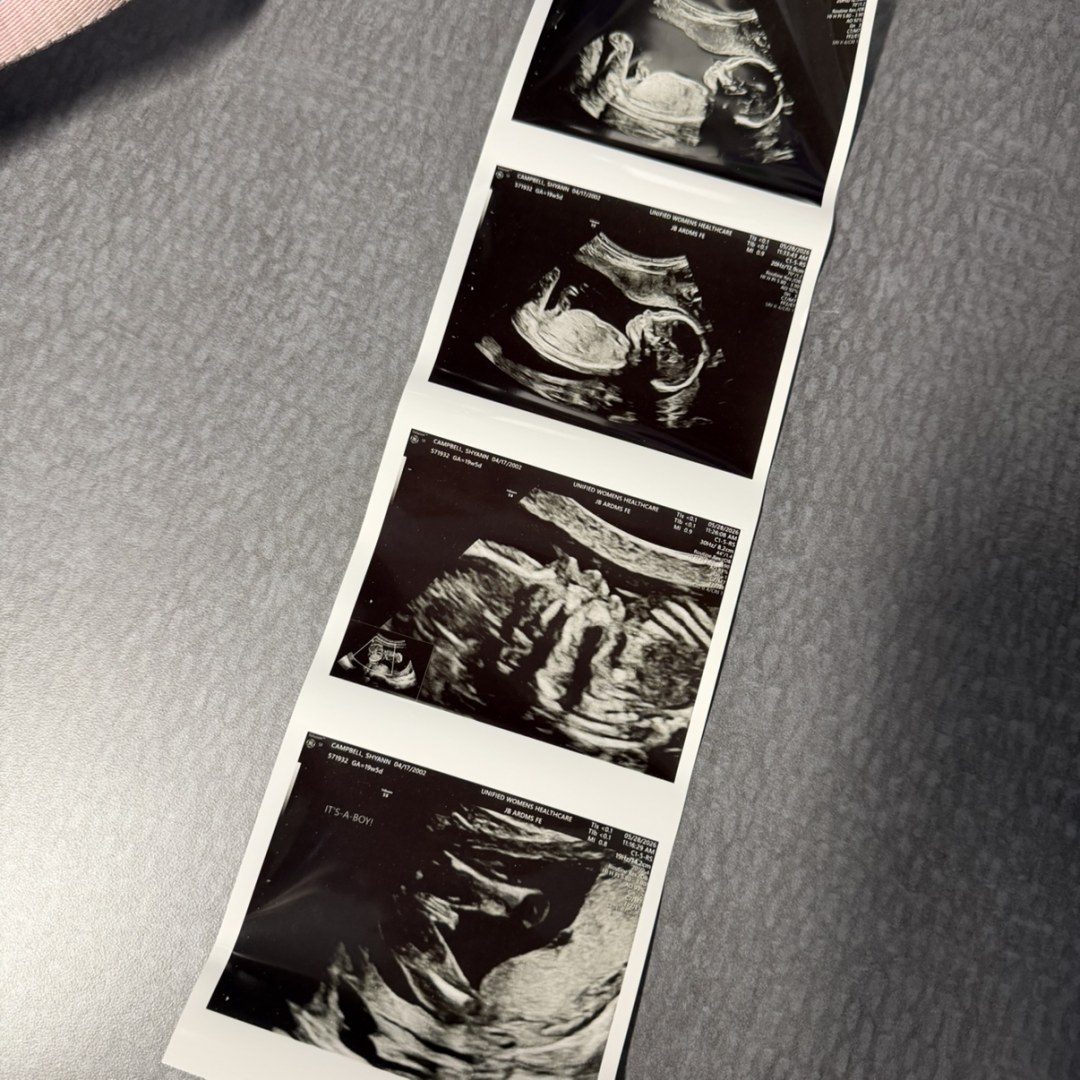 Photo shared by Shyann for their Babylist baby registry.