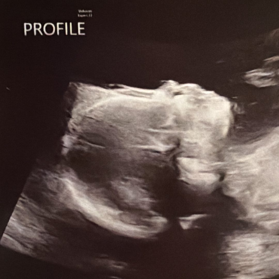 Photo shared by Haleigh for their Babylist baby registry.