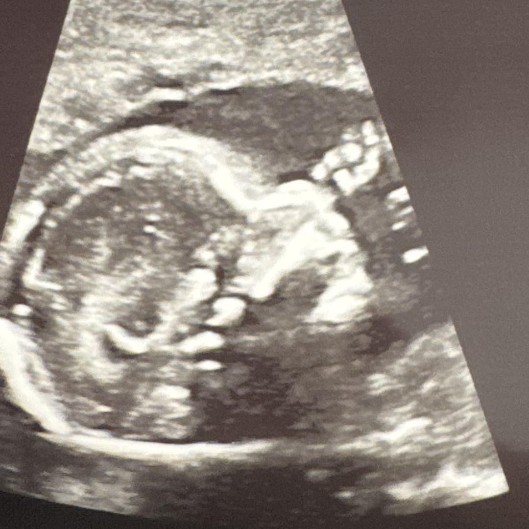 Photo shared by Alisha for their Babylist baby registry.