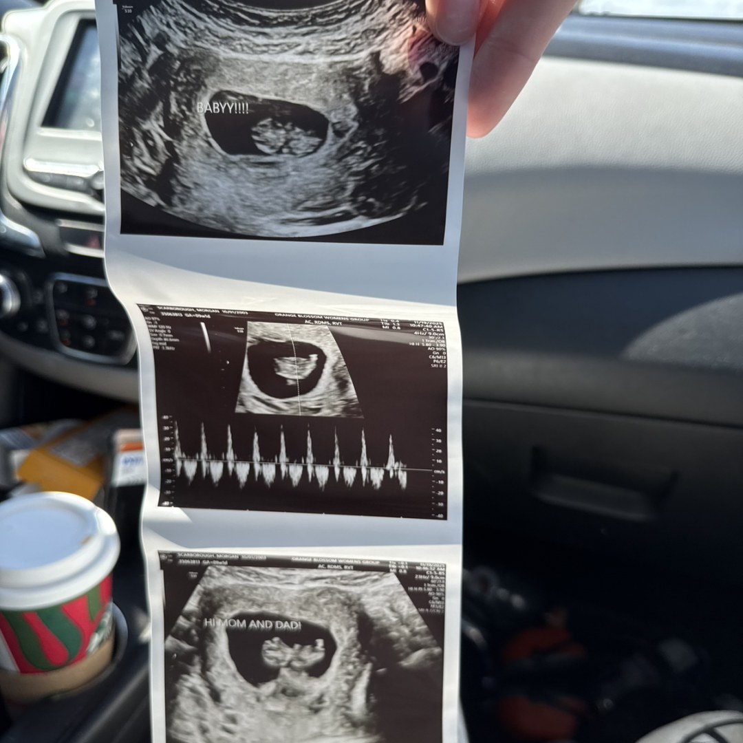 Photo shared by Trey for their Babylist baby registry.