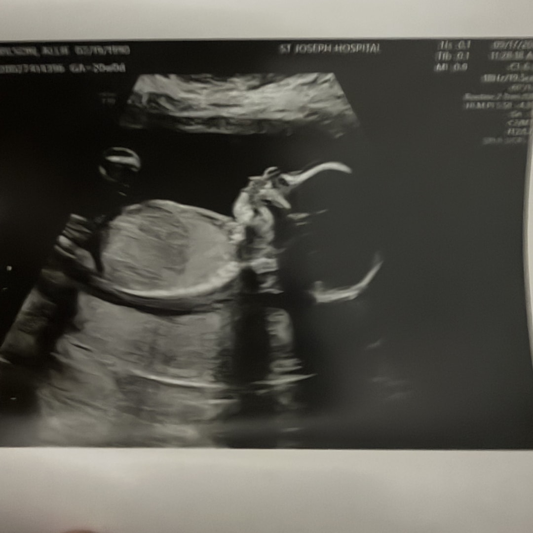 Photo shared by Allie for their Babylist baby registry.