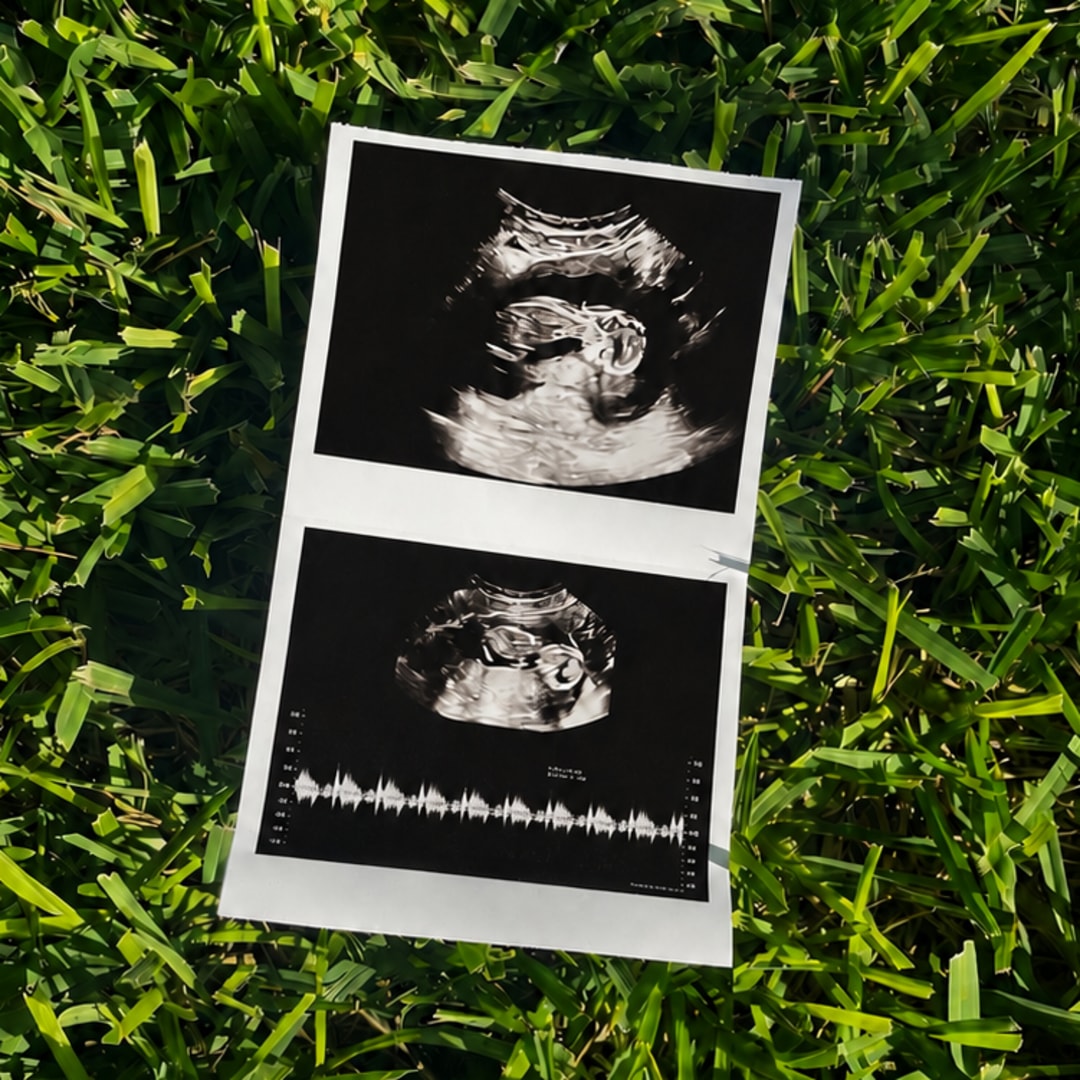 Photo shared by Emilie for their Babylist baby registry.