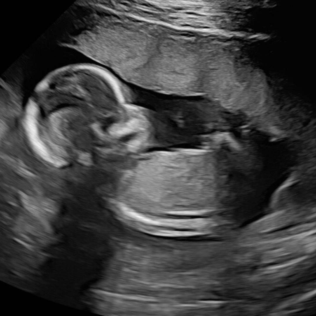 Photo shared by Dani for their Babylist baby registry.