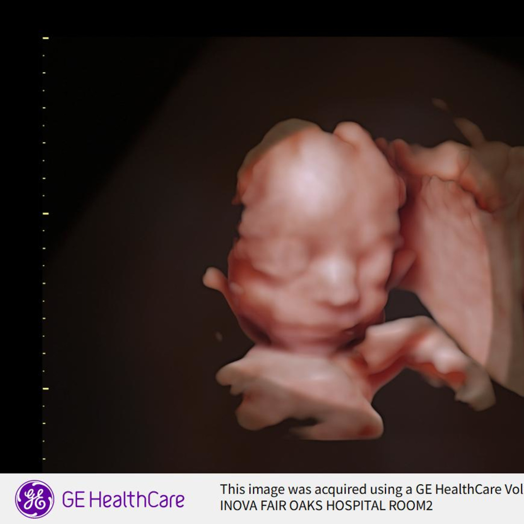 Photo shared by Fernanda for their Babylist baby registry.