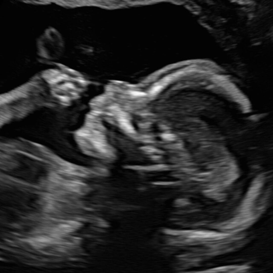 Photo shared by Erin for their Babylist baby registry.