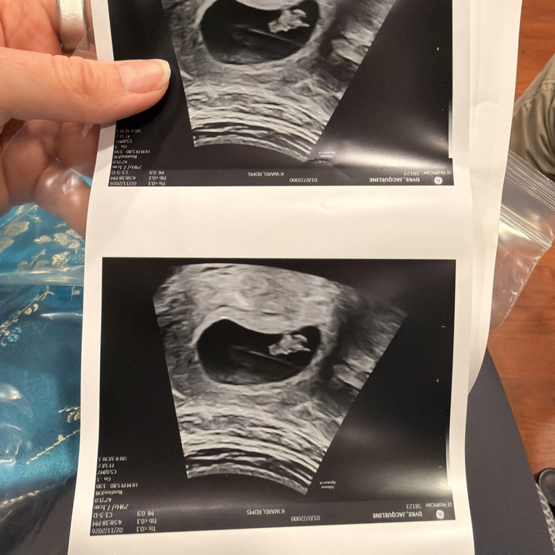 Photo shared by Jackie for their Babylist baby registry.