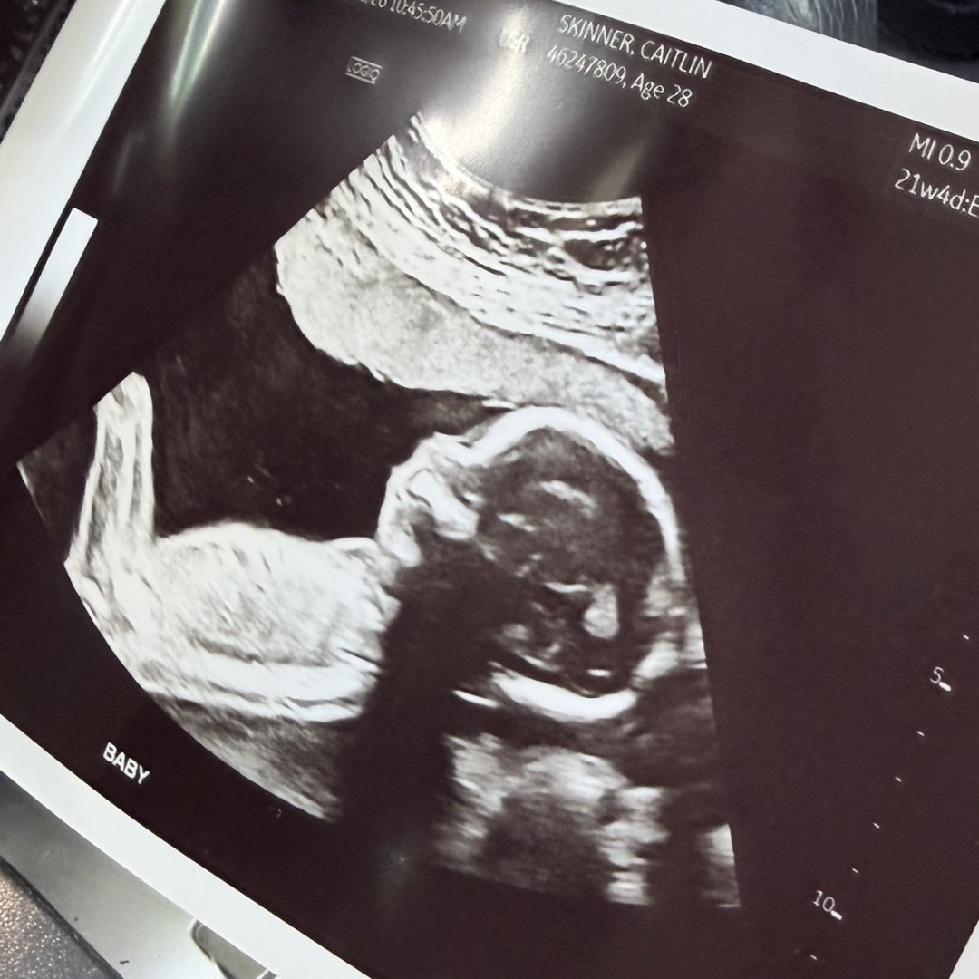 Photo shared by Caitlin for their Babylist baby registry.