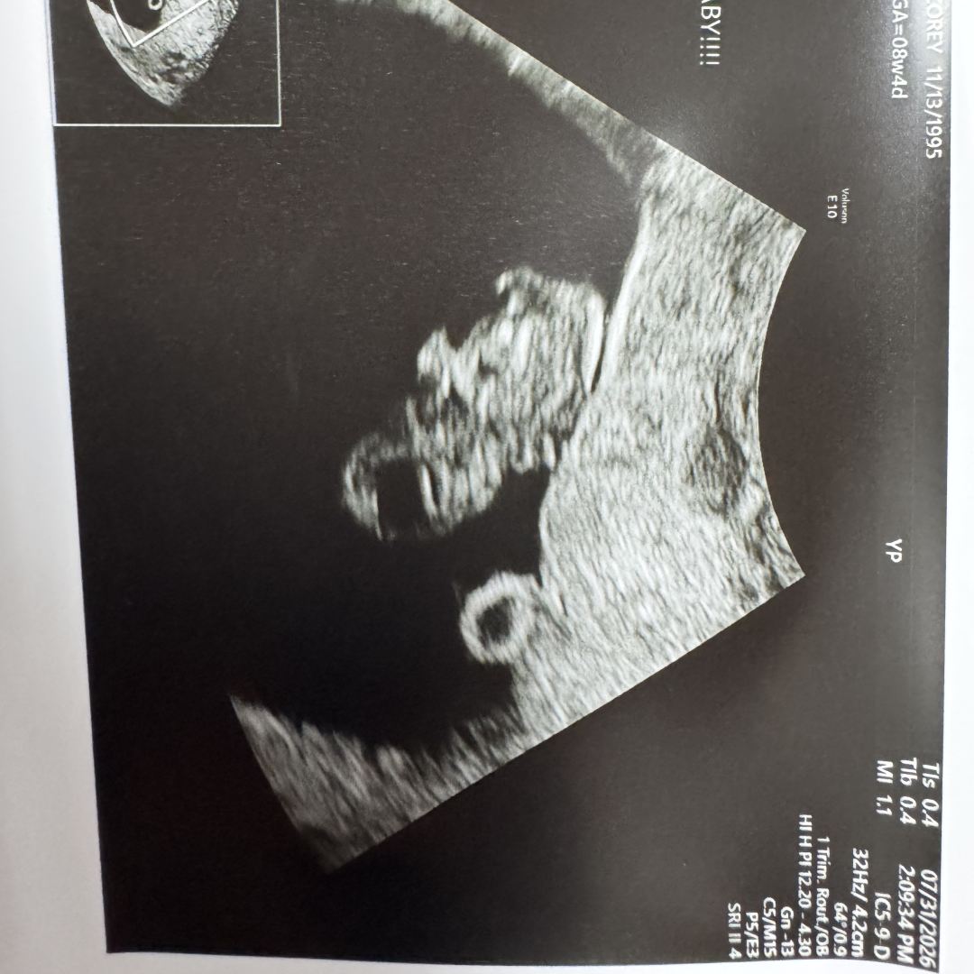 Photo shared by Corey for their Babylist baby registry.