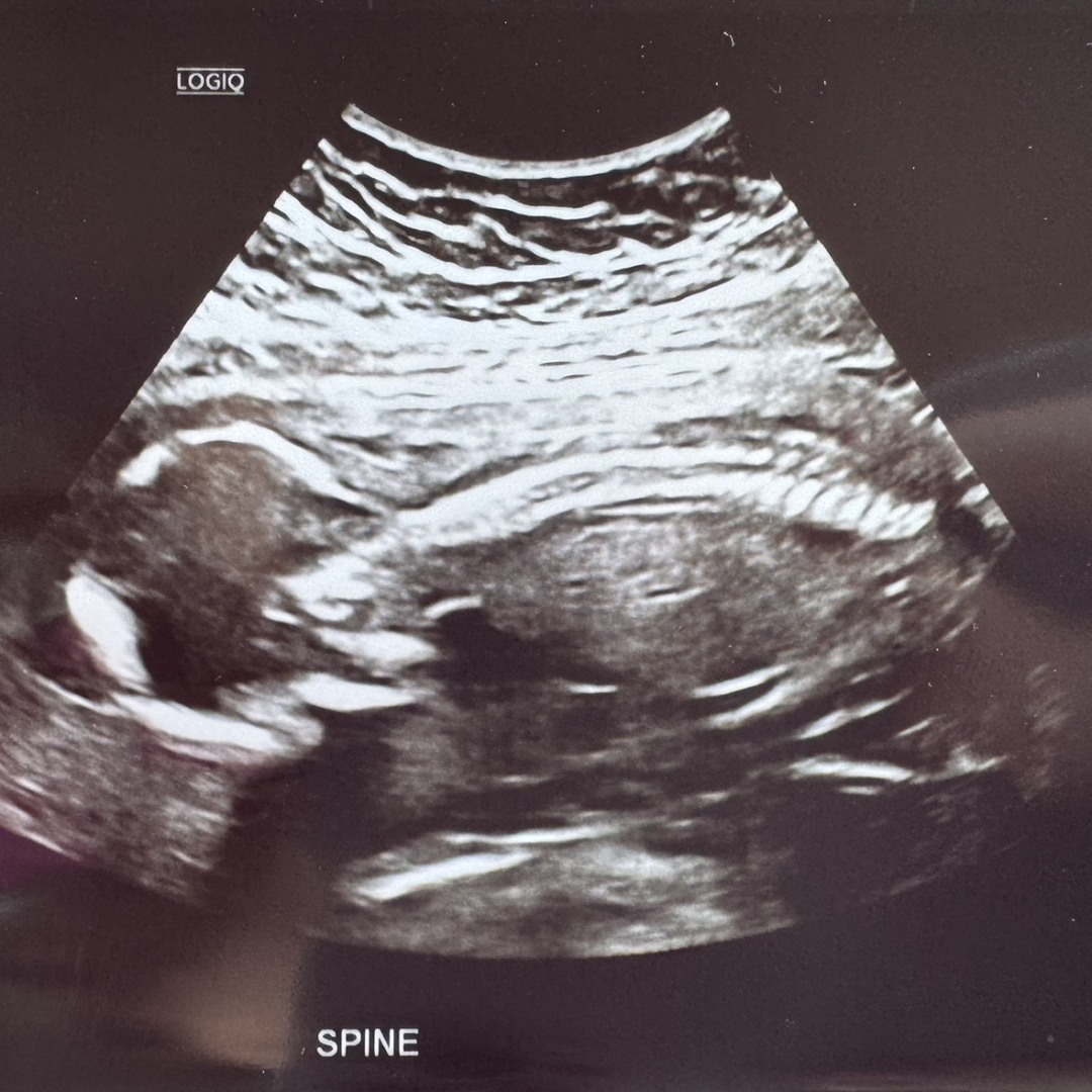 Photo shared by Cassidy for their Babylist baby registry.