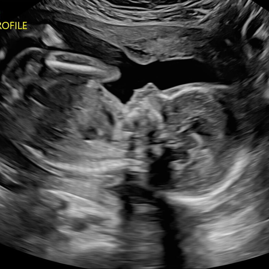 Photo shared by Caitlin and Ryan for their Babylist baby registry.