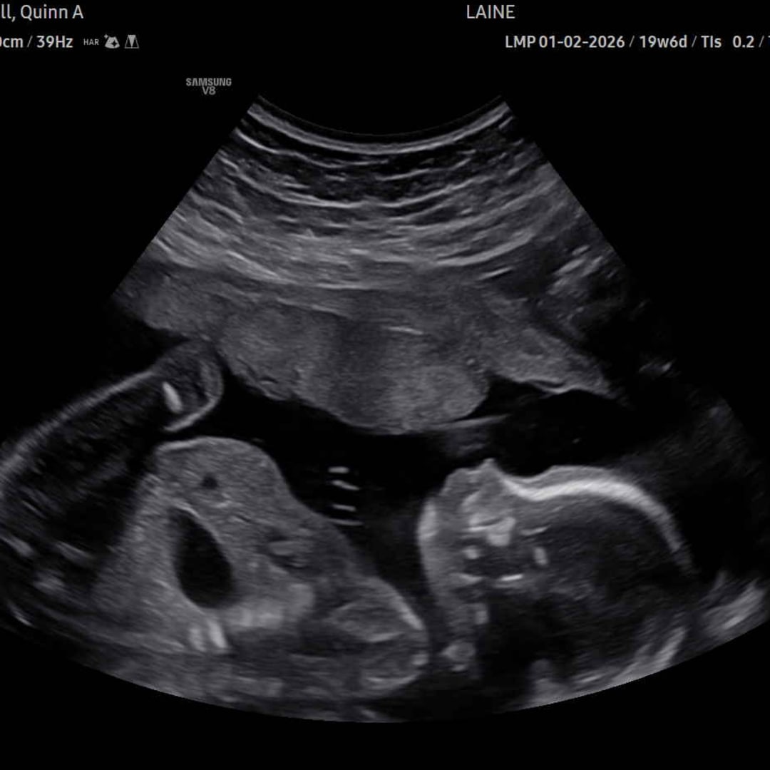 Photo shared by Quinn for their Babylist baby registry.