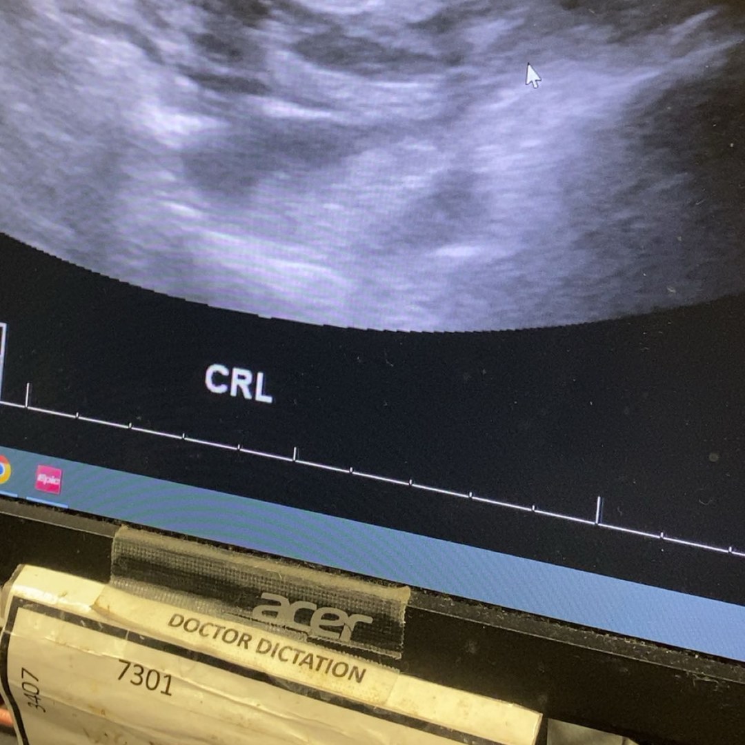 Photo shared by Aryona for their Babylist baby registry.