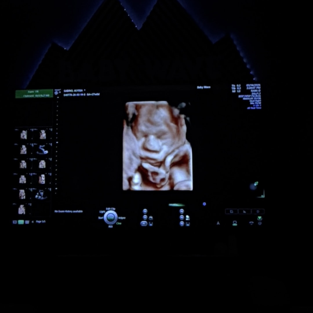 Photo shared by Alyssa for their Babylist baby registry.