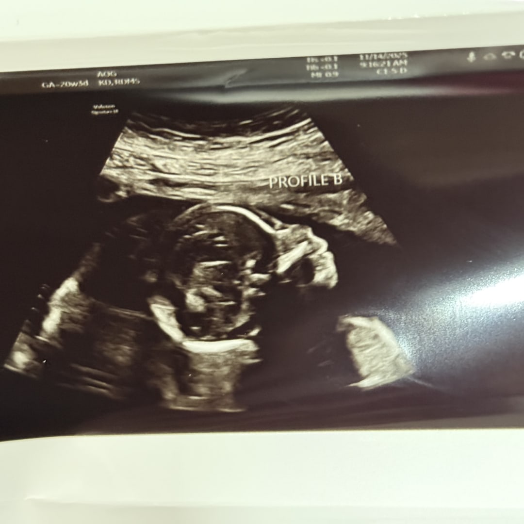 Photo shared by Arizbeth for their Babylist baby registry.