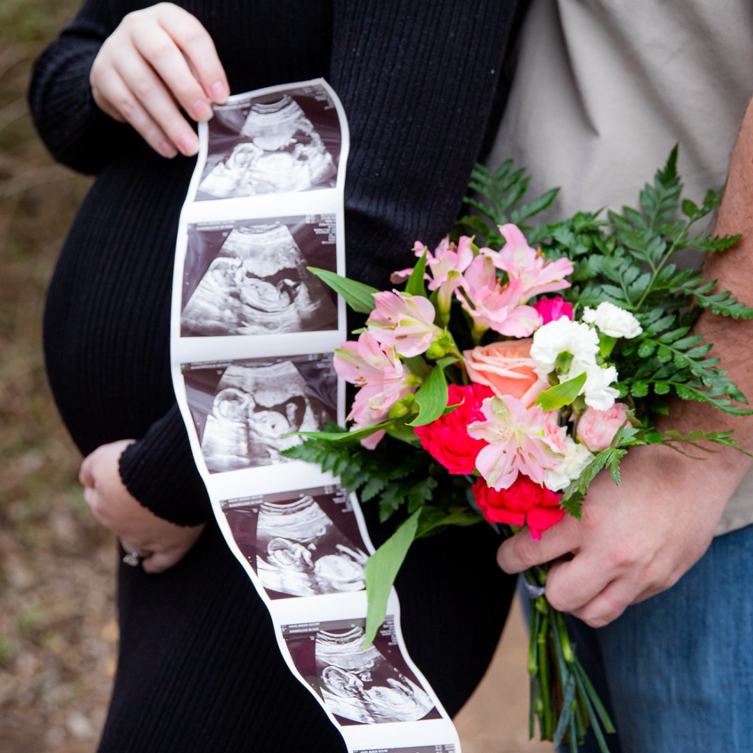 Photo shared by Madison for their Babylist baby registry.