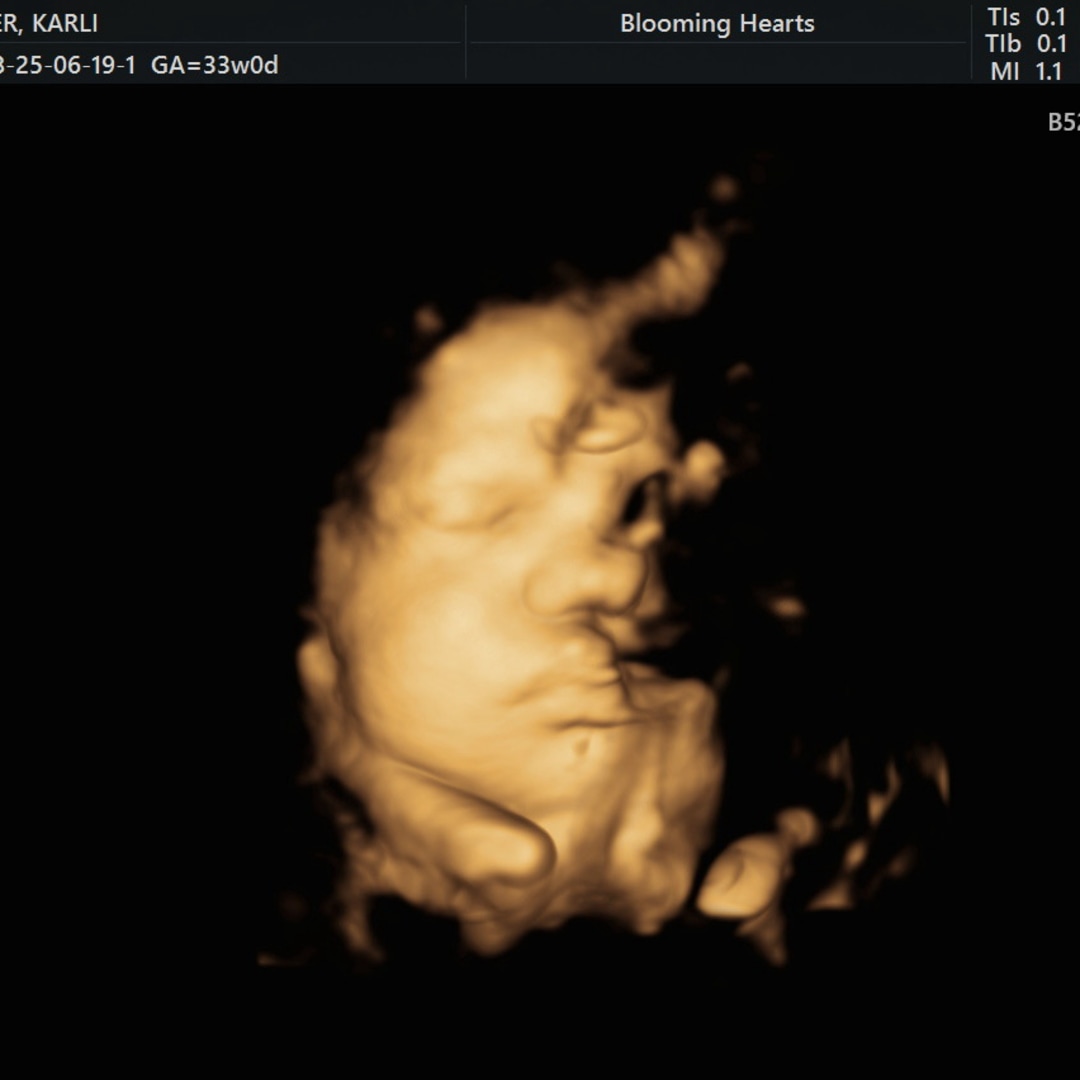 Photo shared by Karli for their Babylist baby registry.