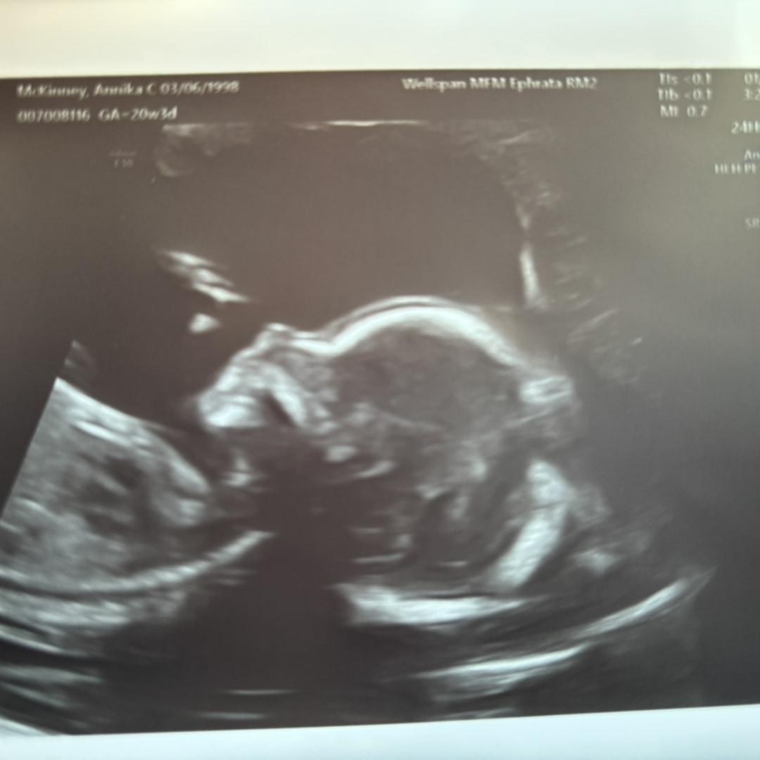 Photo shared by Annika for their Babylist baby registry.