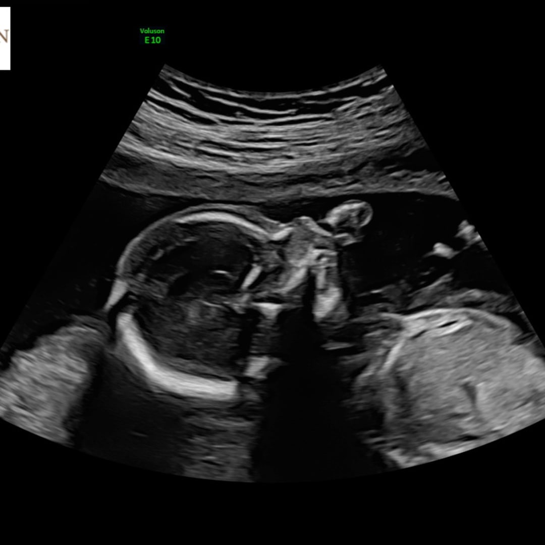 Photo shared by Emily for their Babylist baby registry.