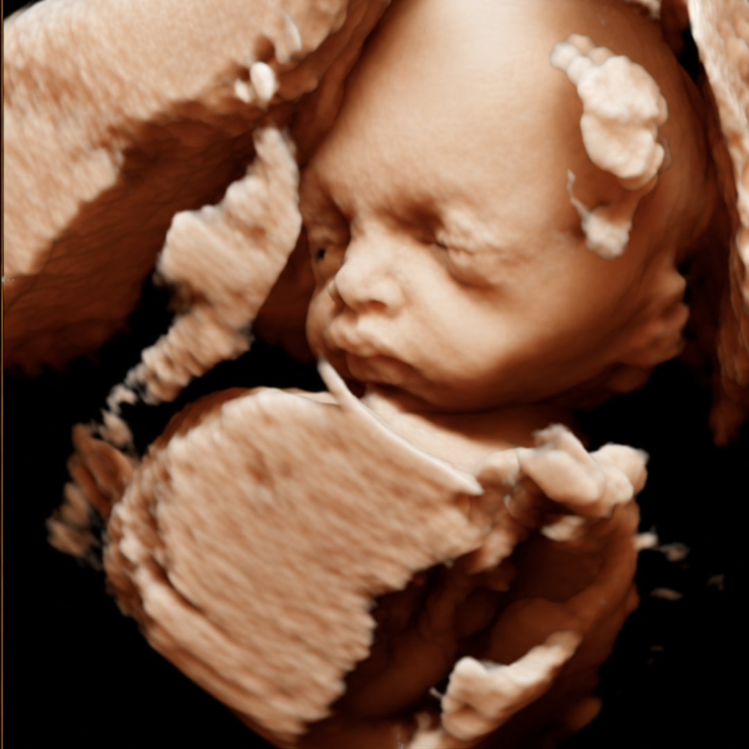 Photo shared by Kaira for their Babylist baby registry.