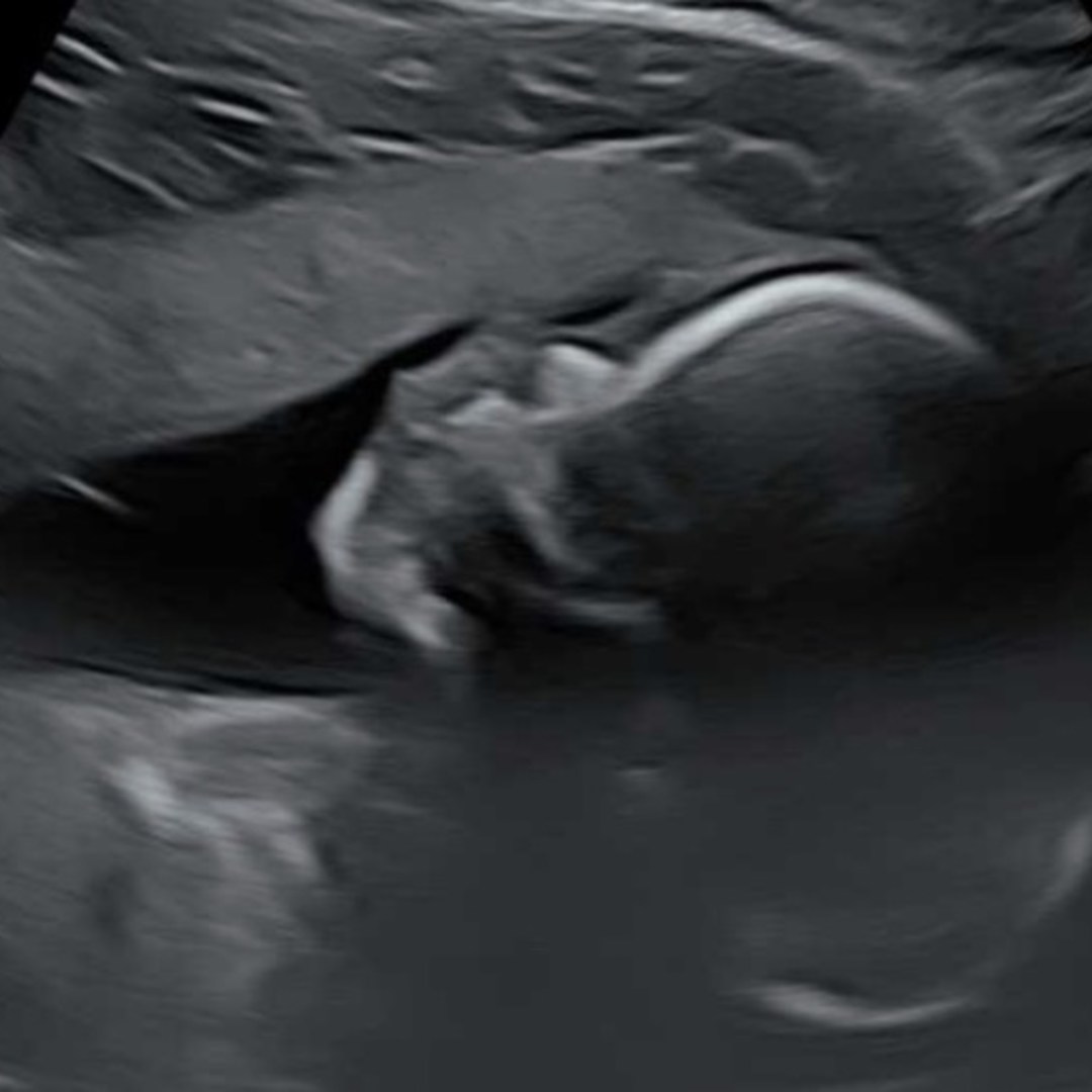Photo shared by Audrey for their Babylist baby registry.