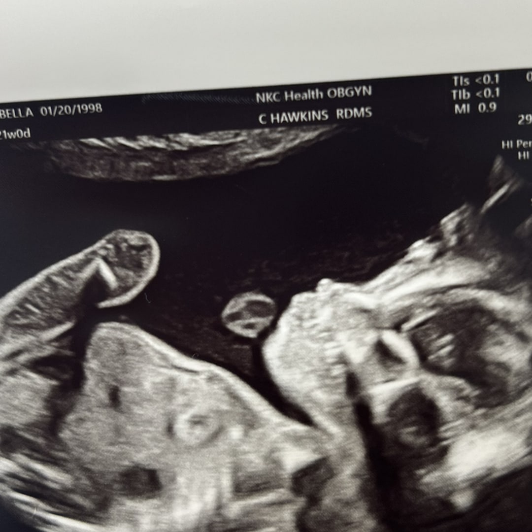 Photo shared by Bella for their Babylist baby registry.