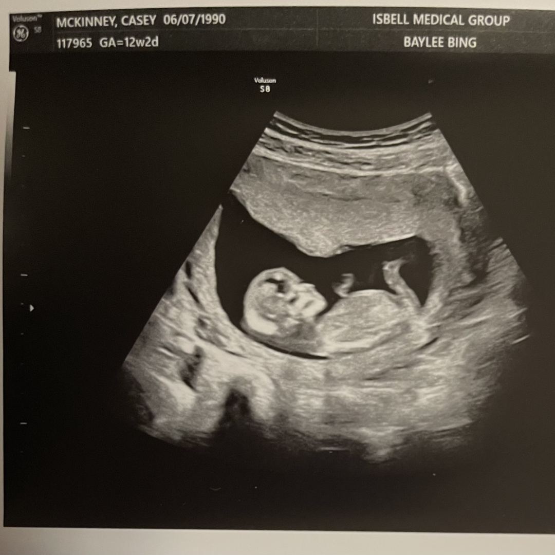 Photo shared by Casey for their Babylist baby registry.