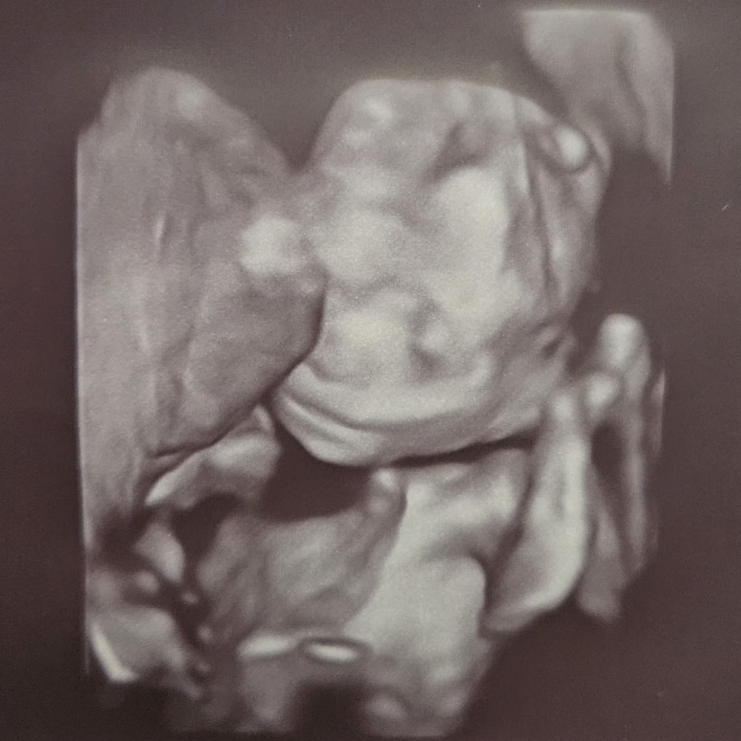 Photo shared by Haley for their Babylist baby registry.