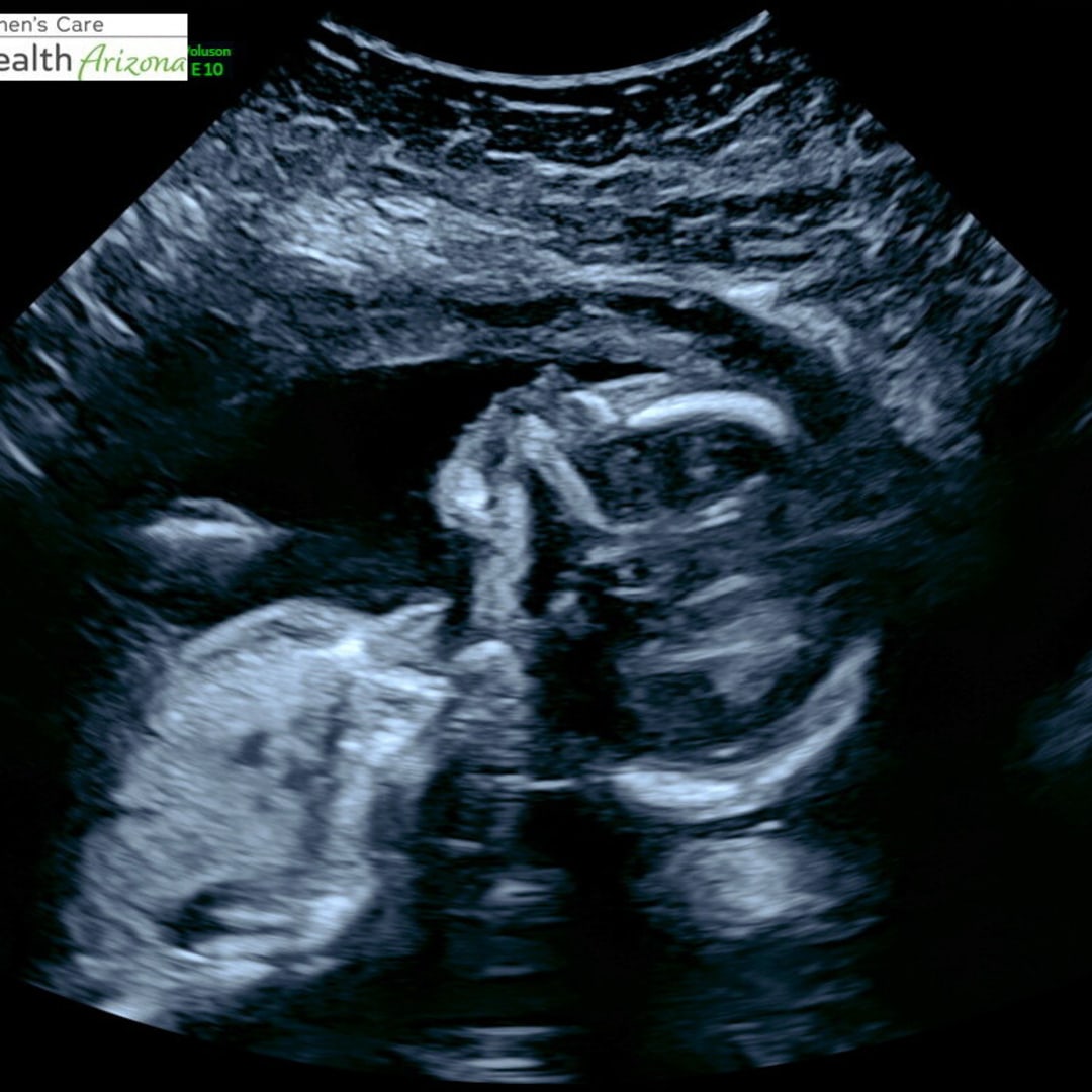 Photo shared by Casadi for their Babylist baby registry.